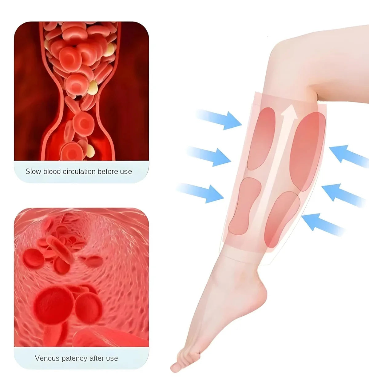 S6 Cordless Leg Massager – Wraparound Airbag Compression Massage