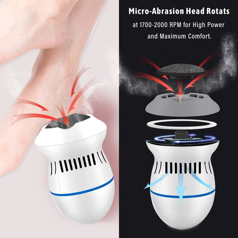 USB Rechargeable Electric Callus Remover – Dual-Speed Foot Care Tool
