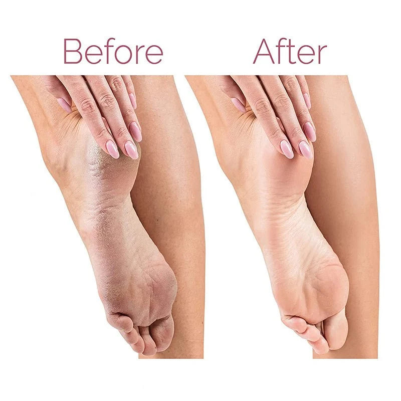 Rechargeable Electric Foot File & Callus Remover – 2 Speeds, 2 Rollers
