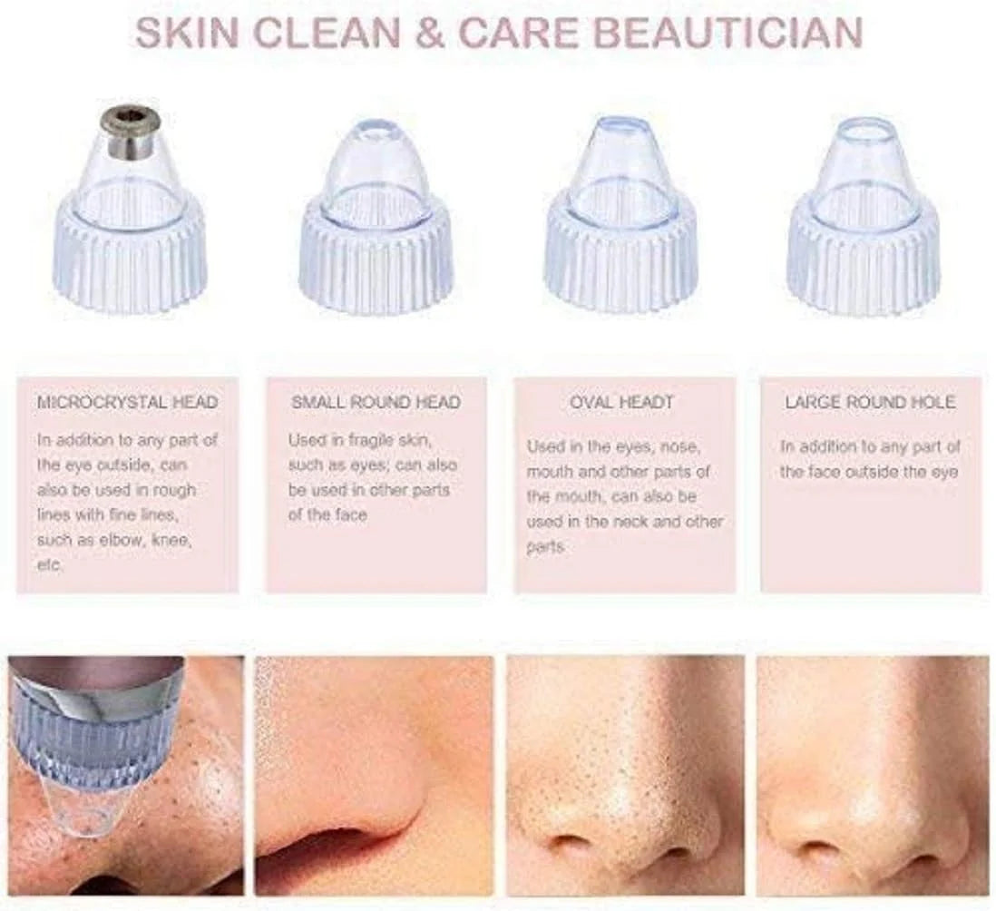 Pore Cleaning Vacuum Device – 5 Suction Levels & 4 Probes